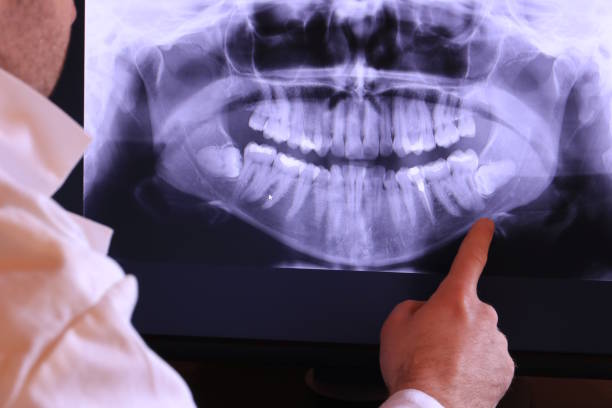 Professional Emergency Dentist in ID